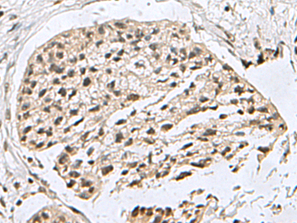 Anti-H2AJ Rabbit Polyclonal Antibody