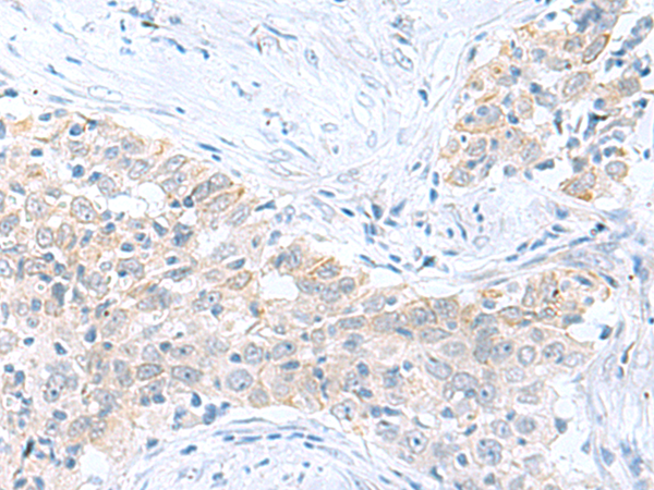 Anti-PDE6D Rabbit Polyclonal Antibody