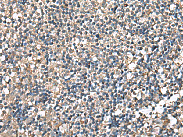 Anti-RPS14 Rabbit Polyclonal Antibody