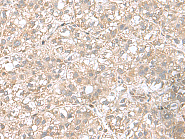 Anti-CPLX3 Rabbit Polyclonal Antibody