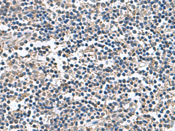 Anti-BLOC1S6 Rabbit Polyclonal Antibody
