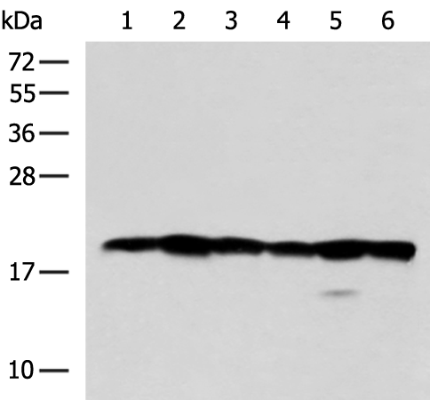 Anti-BLOC1S6 Rabbit Polyclonal Antibody