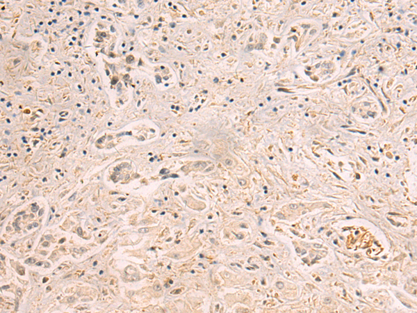 Anti-Troponin I Rabbit Polyclonal Antibody