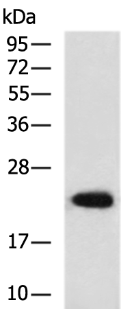 Anti-Troponin I Rabbit Polyclonal Antibody