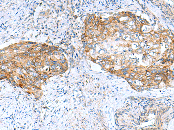 Anti-MRPS28 Rabbit Polyclonal Antibody