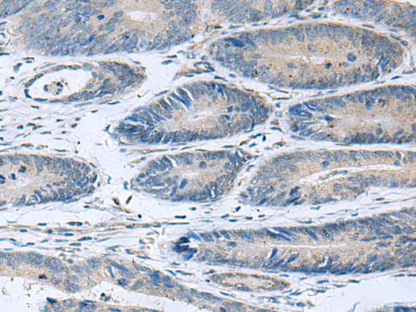 Anti-HPCAL1 Rabbit Polyclonal Antibody