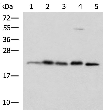 Anti-HPCAL1 Rabbit Polyclonal Antibody