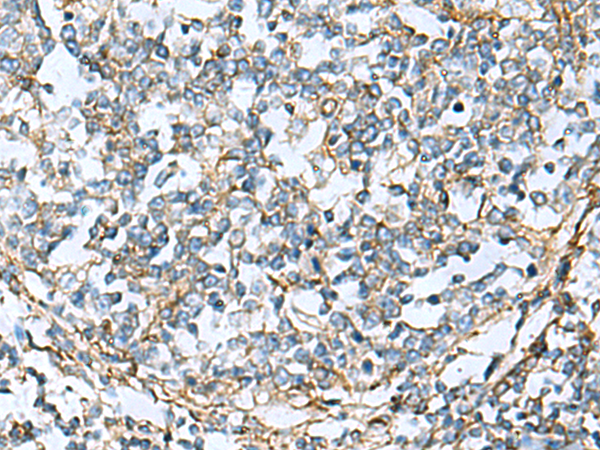 Anti-Clathrin Light Chain B Rabbit Polyclonal Antibody