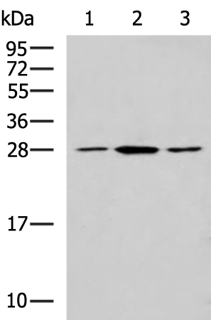 Anti-Clathrin Light Chain B Rabbit Polyclonal Antibody