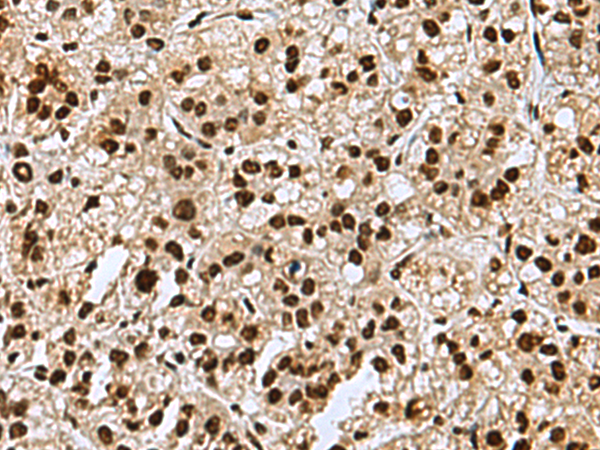 Anti-MYEF2 Rabbit Polyclonal Antibody