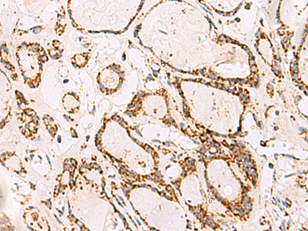 Anti-ATP5PO Rabbit Polyclonal Antibody