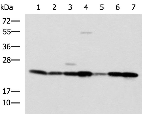 Anti-ATP5PO Rabbit Polyclonal Antibody