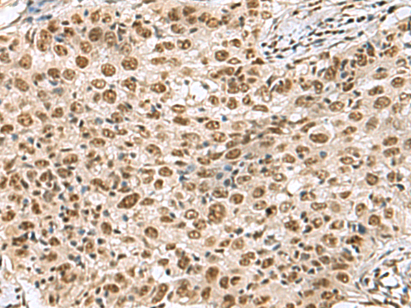 Anti-PRPF40A Rabbit Polyclonal Antibody