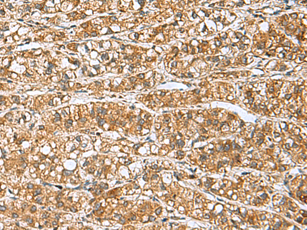 Anti-GINS3 Rabbit Polyclonal Antibody