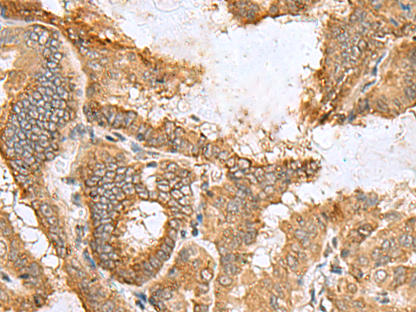 Anti-CCDC134 Rabbit Polyclonal Antibody
