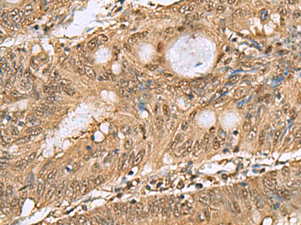 Anti-Proteasome alpha 6 Rabbit Polyclonal Antibody