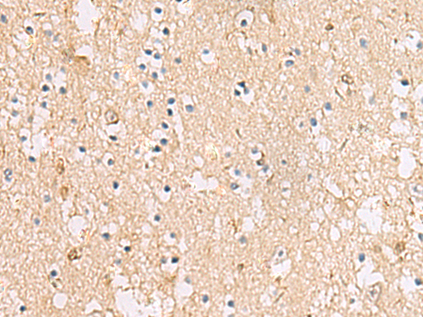 Anti-PLEKHF2 Rabbit Polyclonal Antibody
