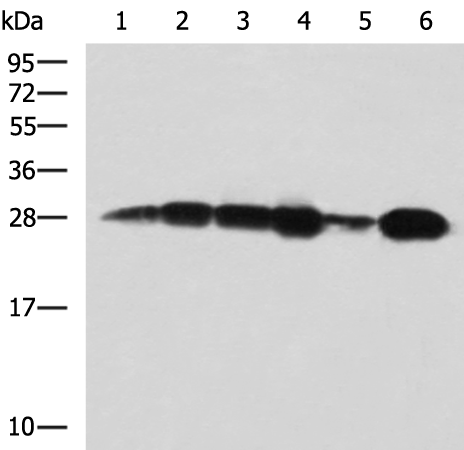 Anti-MMAB Rabbit Polyclonal Antibody