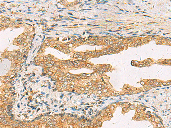 Anti-STX6 Rabbit Polyclonal Antibody