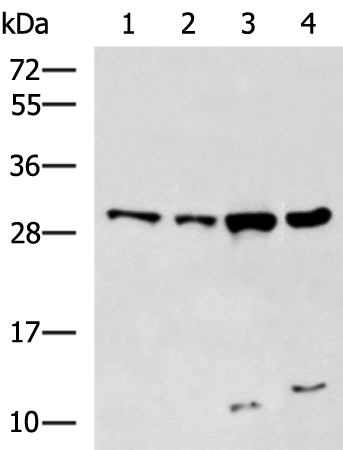 Anti-KCNIP3 Rabbit Polyclonal Antibody
