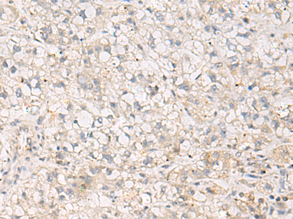 Anti-Troponin T Rabbit Polyclonal Antibody