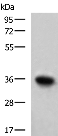 Anti-Troponin T Rabbit Polyclonal Antibody
