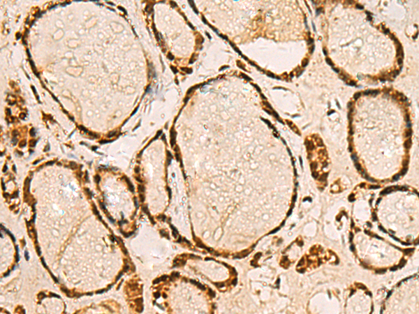 Anti-CMAS Rabbit Polyclonal Antibody