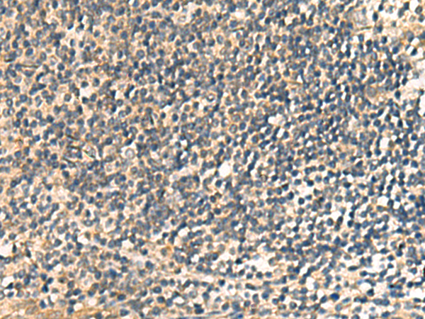 Anti-CNST Rabbit Polyclonal Antibody
