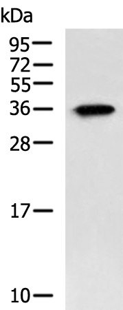 Anti-SPACA1 Rabbit Polyclonal Antibody