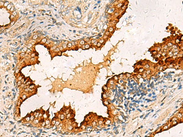 Anti-PDCL Rabbit Polyclonal Antibody