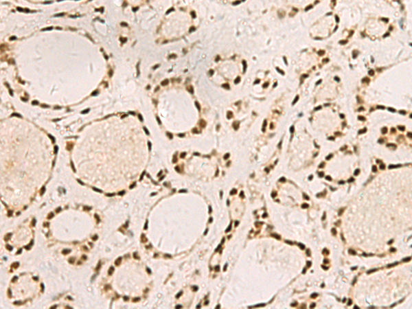 Anti-SAP30BP Rabbit Polyclonal Antibody