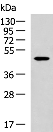 Anti-SAP30BP Rabbit Polyclonal Antibody