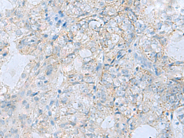 Anti-PYCR2 Rabbit Polyclonal Antibody