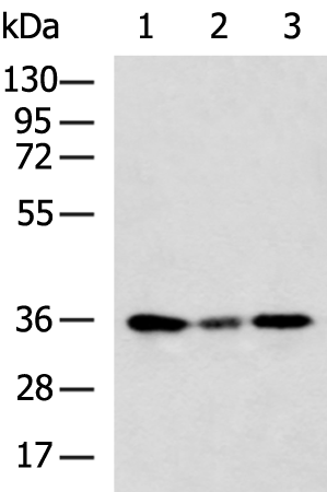 Anti-PYCR2 Rabbit Polyclonal Antibody