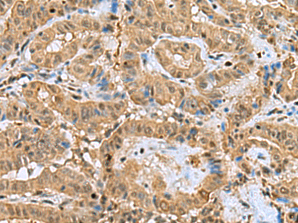 Anti-PPP2R4 Rabbit Polyclonal Antibody