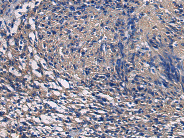Anti-SSH3 Rabbit Polyclonal Antibody