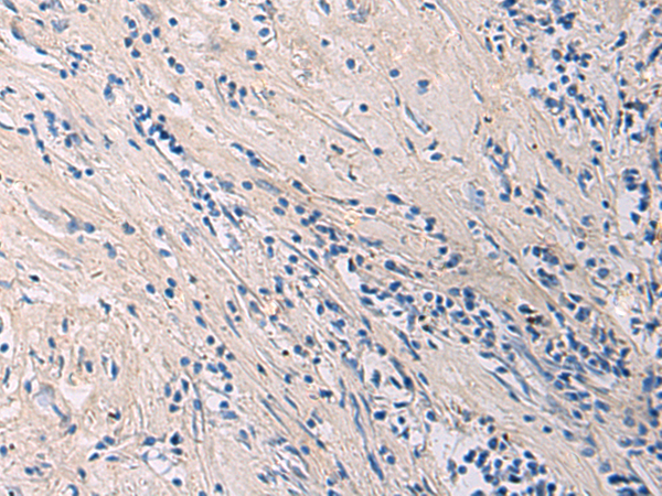 Anti-GALM Rabbit Polyclonal Antibody