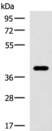 Anti-GALM Rabbit Polyclonal Antibody