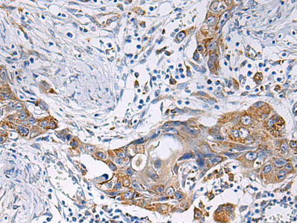 Anti-HSDL2 Rabbit Polyclonal Antibody