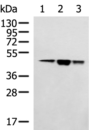 Anti-HSDL2 Rabbit Polyclonal Antibody