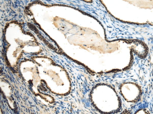 Anti-KMT1B Rabbit Polyclonal Antibody