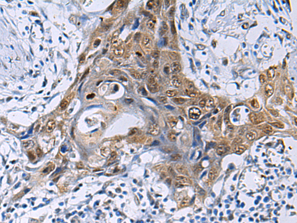 Anti-THOC3 Rabbit Polyclonal Antibody