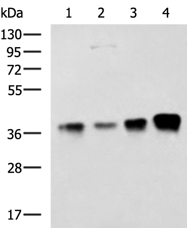 Anti-THOC3 Rabbit Polyclonal Antibody