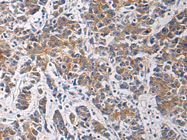 Anti-Tropomodulin 3 Rabbit Polyclonal Antibody