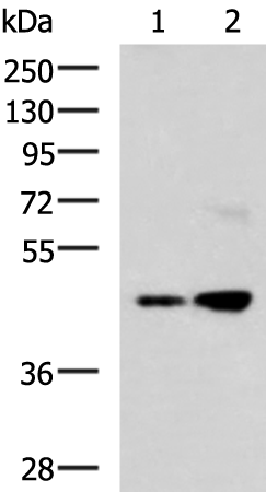 Anti-Tropomodulin 3 Rabbit Polyclonal Antibody