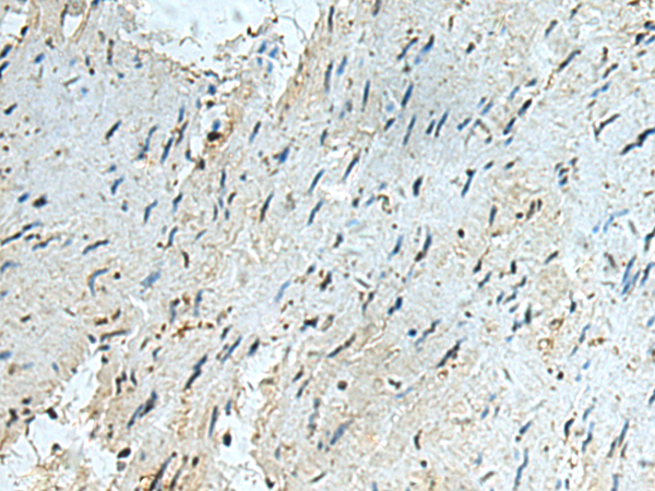 Anti-RAPSN Rabbit Polyclonal Antibody