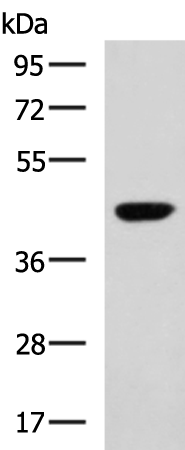 Anti-RAPSN Rabbit Polyclonal Antibody