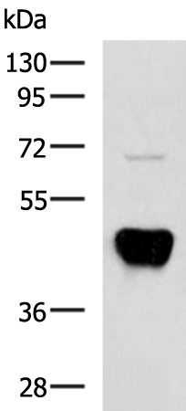 Anti-POC1A Rabbit Polyclonal Antibody
