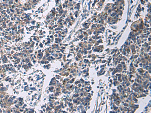 Anti-SLC30A3 Rabbit Polyclonal Antibody