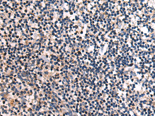 Anti-PIPOX Rabbit Polyclonal Antibody